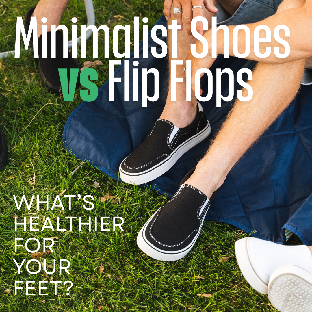 Minimalist Shoes vs. Flip-Flops: What’s Healthier for Your Feet This S ...